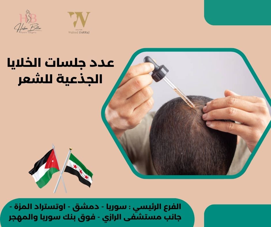 علاج الخلايا الجذعية في الاردن