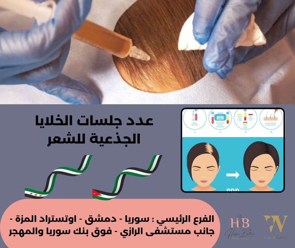 الخلايا المجهرية للشعر في الأردن