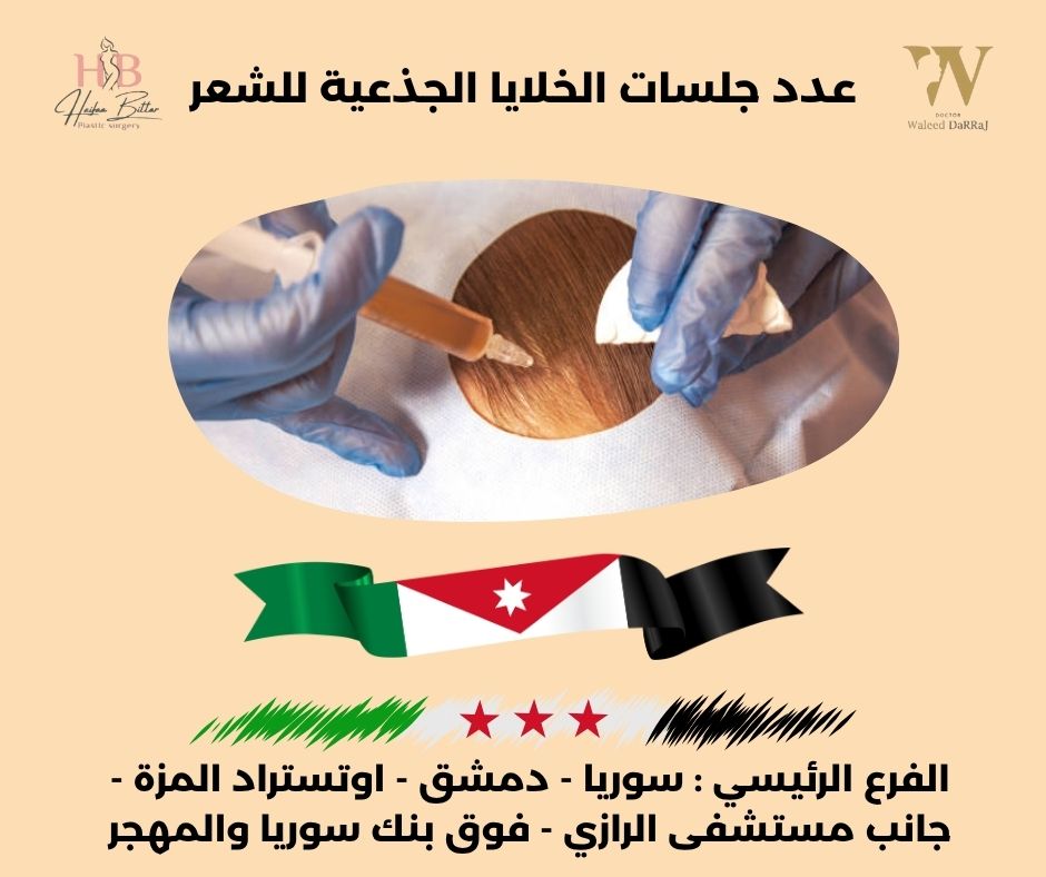 عدد جلسات الخلايا الجذعية للشعر