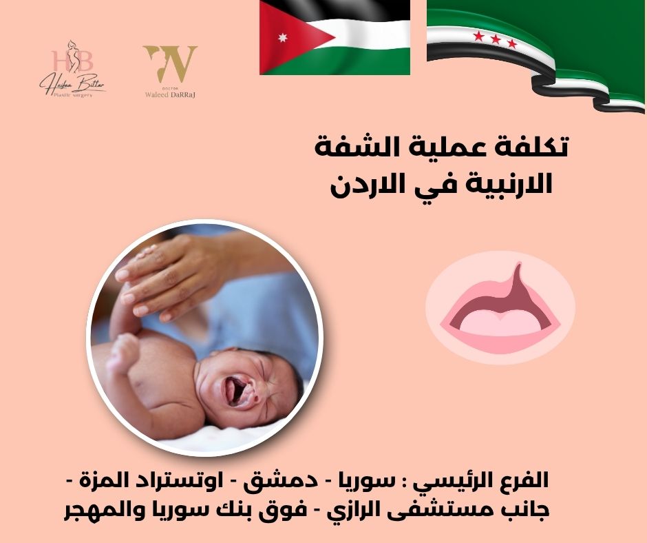 تكلفة عملية الشفة الأرنبية في الأردن