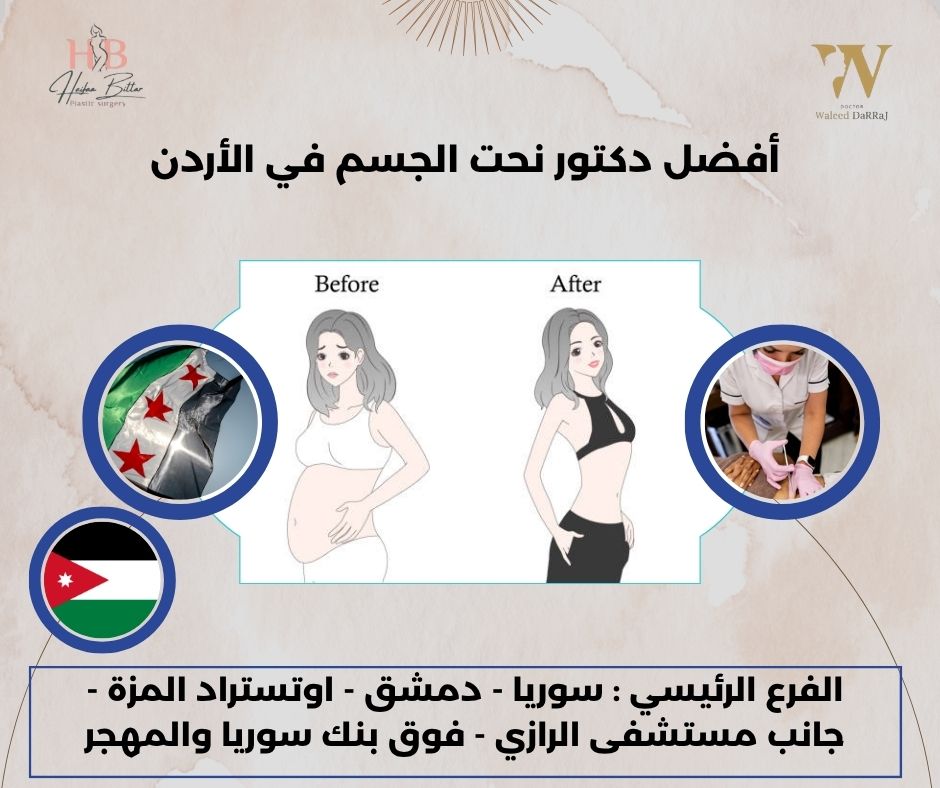 أفضل دكتور نحت الجسم في الأردن أفضل دكتور نحت الجسم في الأردن
