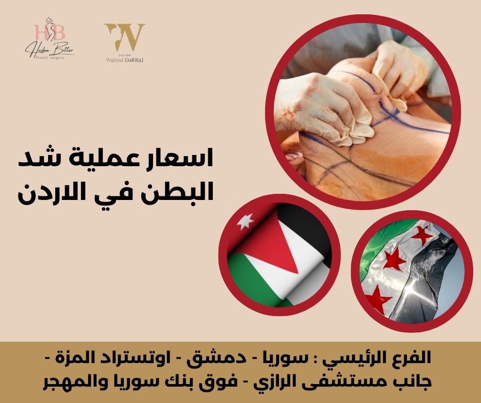 اسعار عملية شد البطن في الاردن