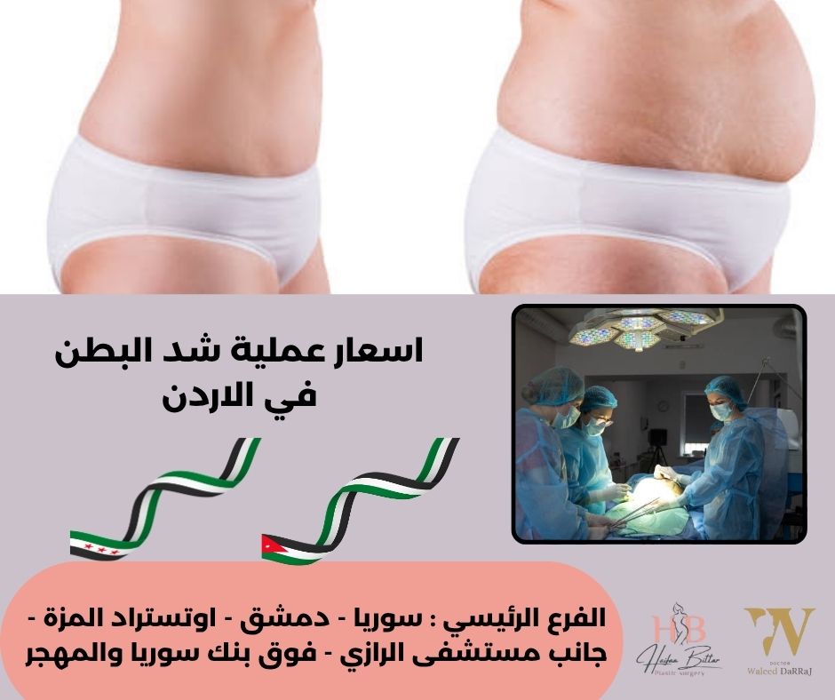 كم تكلفة عملية شد البطن في الاردن