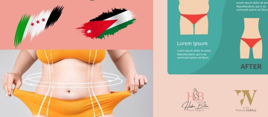 اسعار عملية شد البطن في الاردن