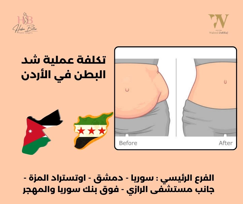 تكلفة عملية شد البطن في الأردن