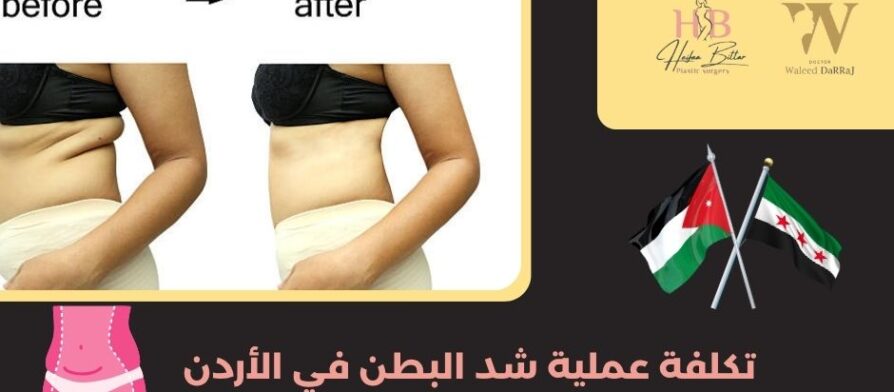 تكلفة عملية شد البطن في الأردن