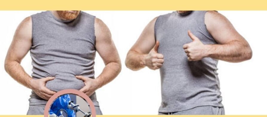 افضل طبيب تكميم في الاردن