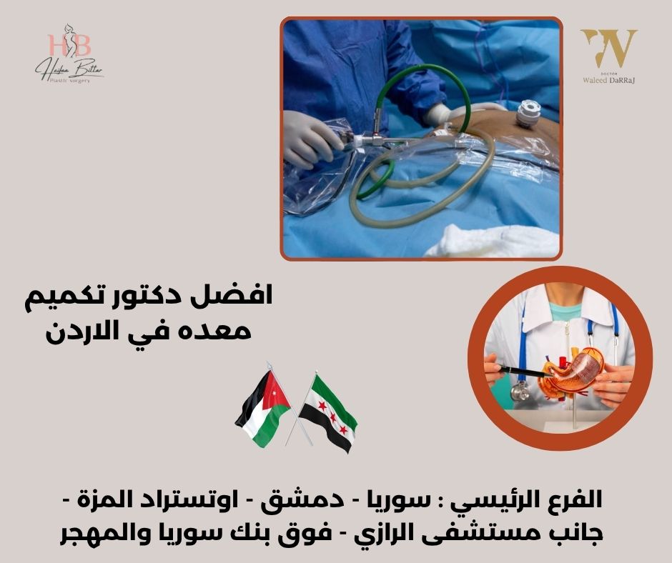 افضل دكاترة تكميم في الاردن