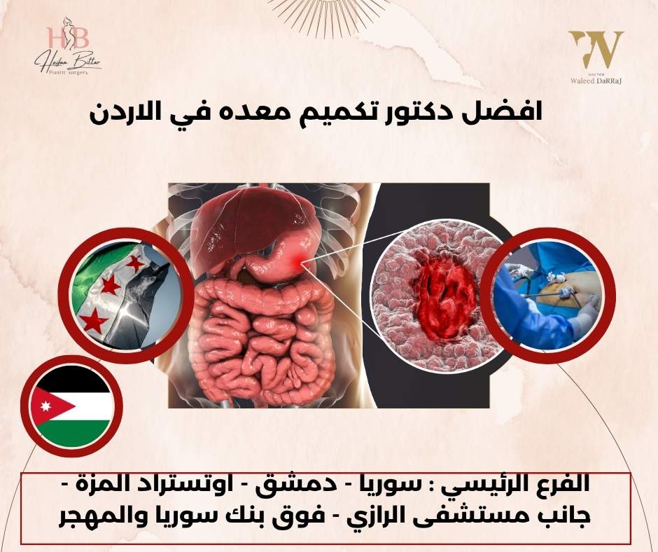 افضل دكتور تكميم معده في الاردن