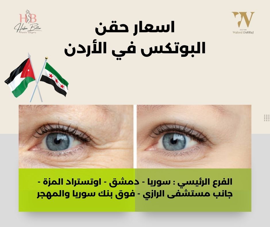 اسعار حقن البوتكس في المعدة في الأردن