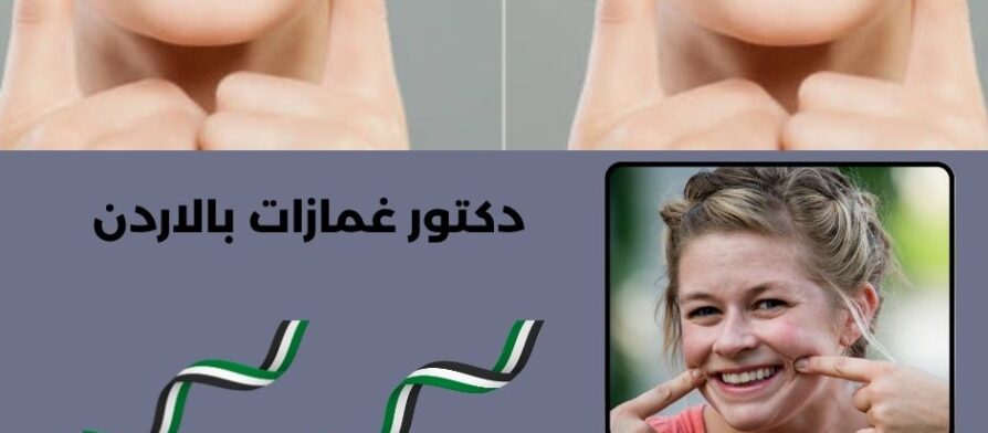 دكتور غمازات بالاردن