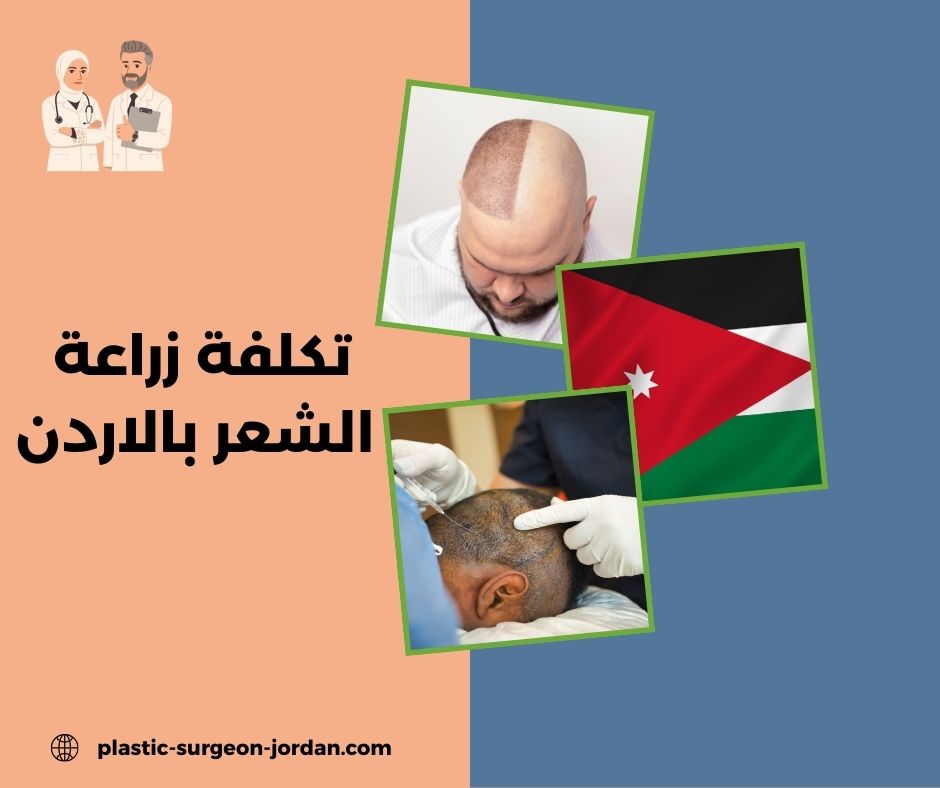 تكلفة زراعة الخلايا الجذعية في الأردن تكلفة زراعة الخلايا الجذعية في الأردن