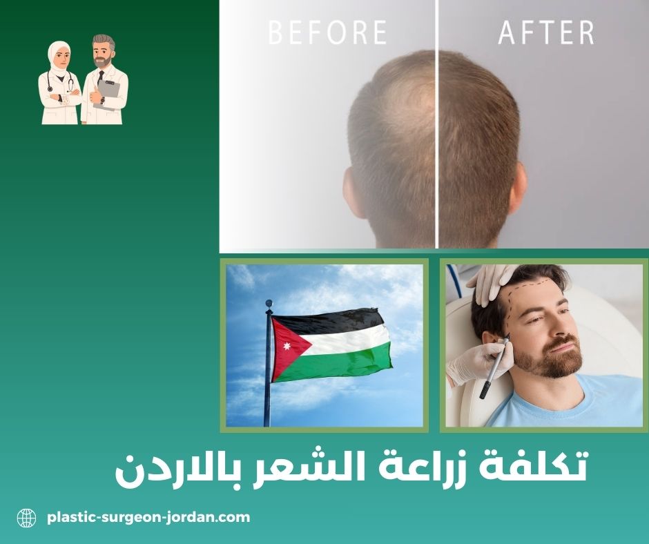 سعر ابرة الفيلر في الأردن سعر ابرة الفيلر في الأردن