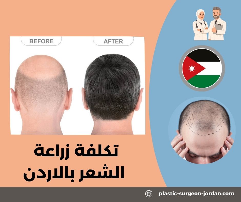 سعر جلسة الليزر لإزالة آثار الجروح في الأردن سعر جلسة الليزر لإزالة آثار الجروح في الأردن