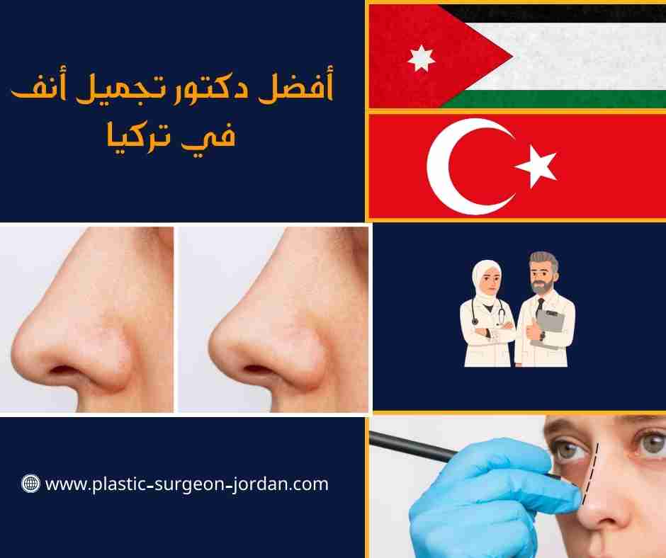 أفضل دكتور تجميل أنف في تركيا