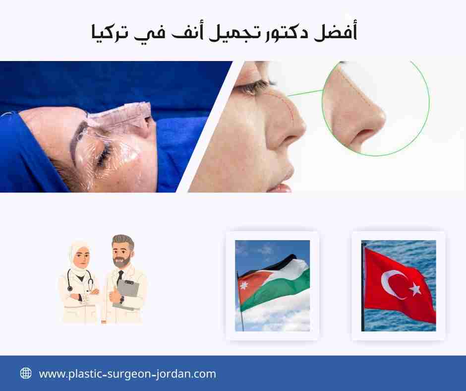 أفضل دكتور تجميل أنف في تركيا