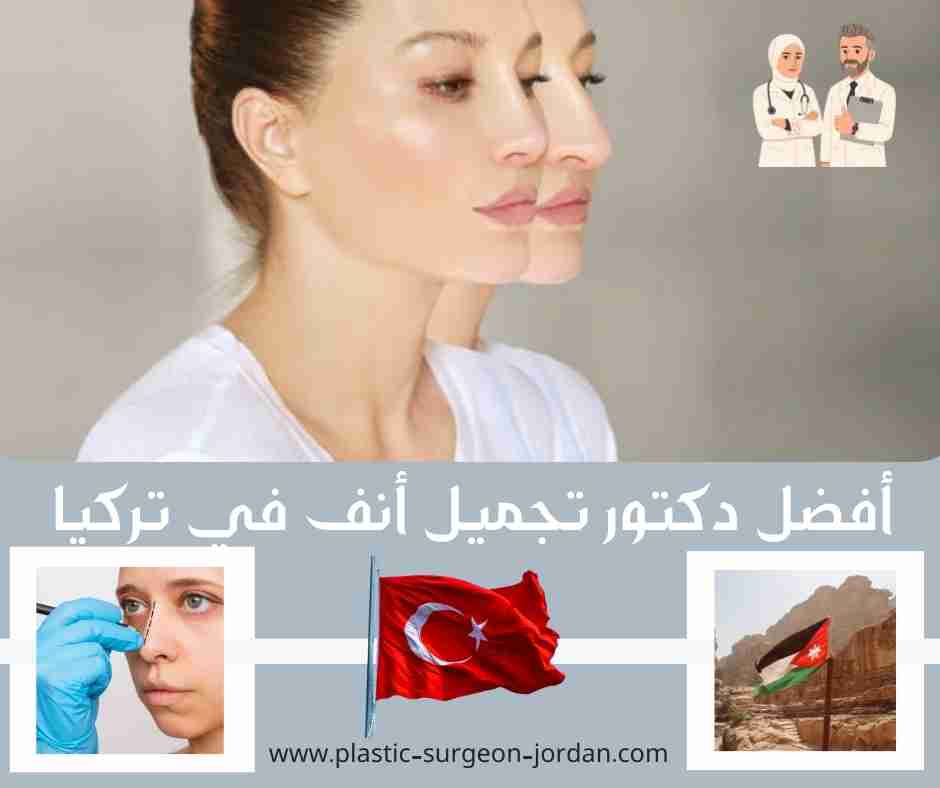 أفضل دكتور تجميل أنف في تركيا