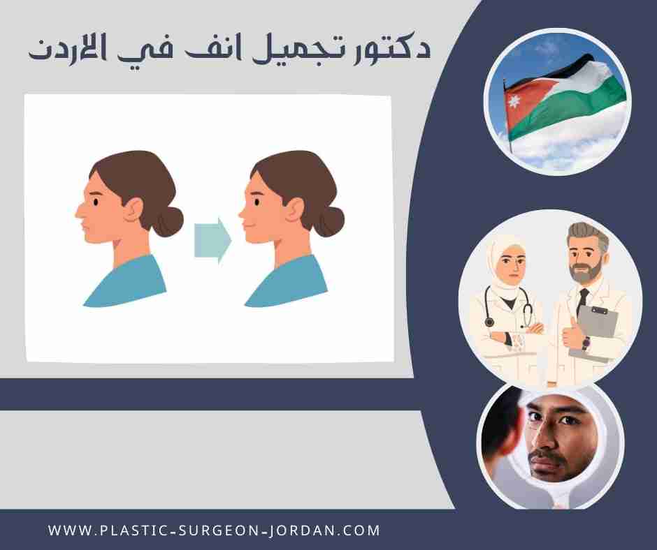 دكتور تجميل انف في الاردن