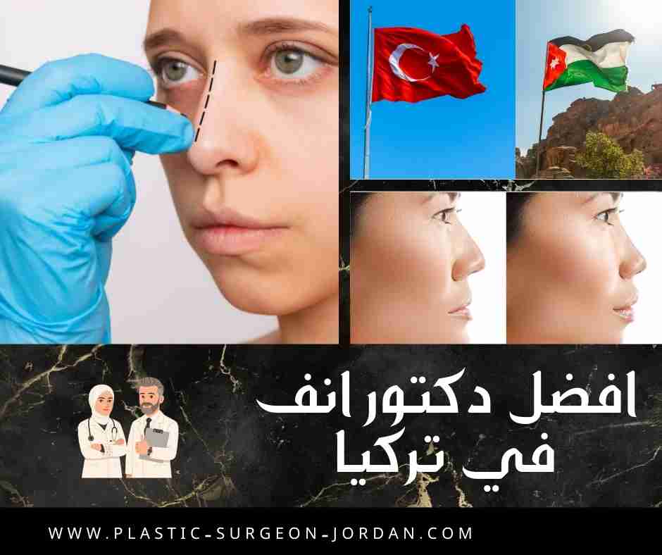 افضل دكتور انف في تركيا