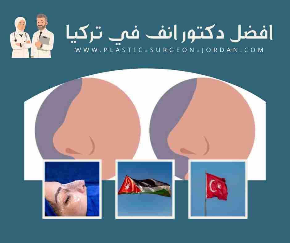 افضل دكتور انف في تركيا