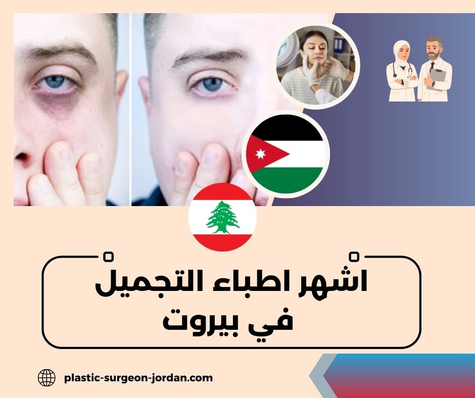اشهر اطباء التجميل في بيروت