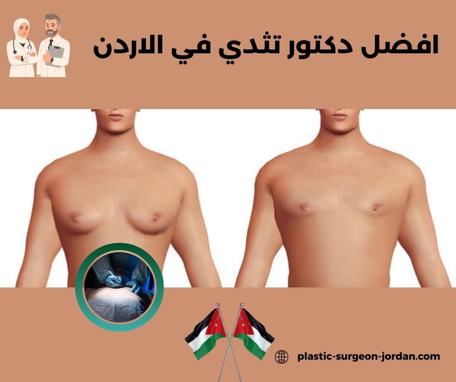 افضل دكتور ثدي في الاردن