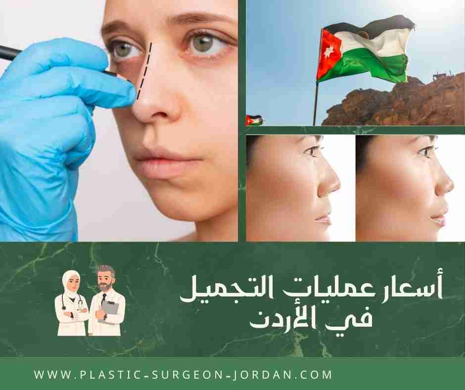 أسعار عمليات التجميل في الأردن