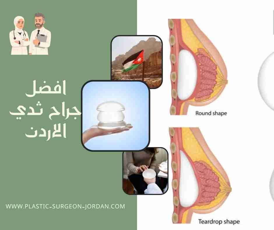 افضل جراح ثدي الاردن