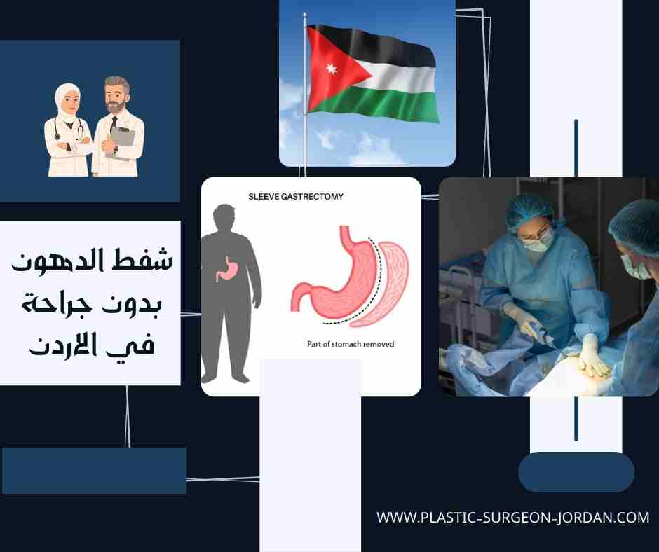 شفط الدهون بدون جراحة في الاردن