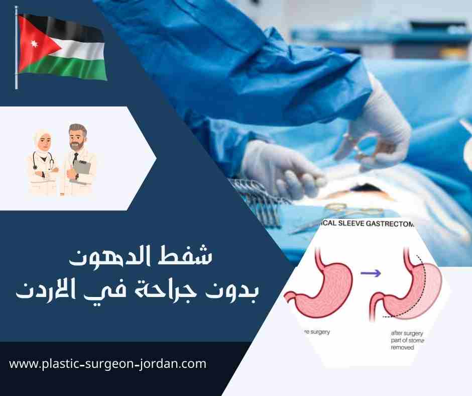 شفط الدهون بدون جراحة في الاردن
