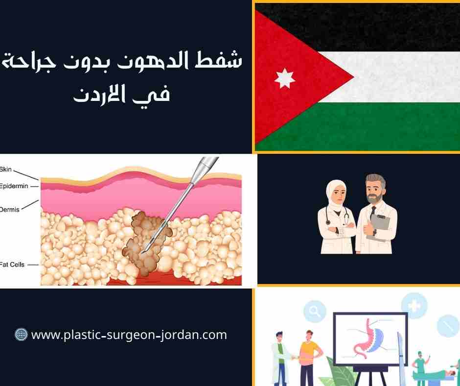 شفط الدهون بدون جراحة في الاردن