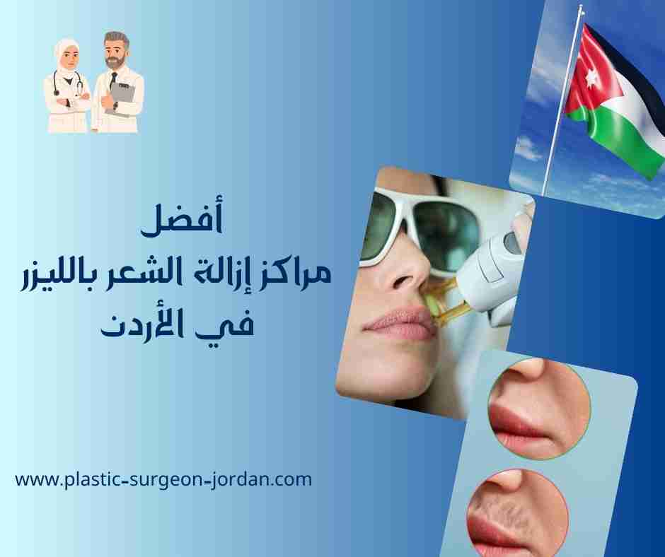 أفضل مراكز إزالة الشعر بالليزر في الأردن