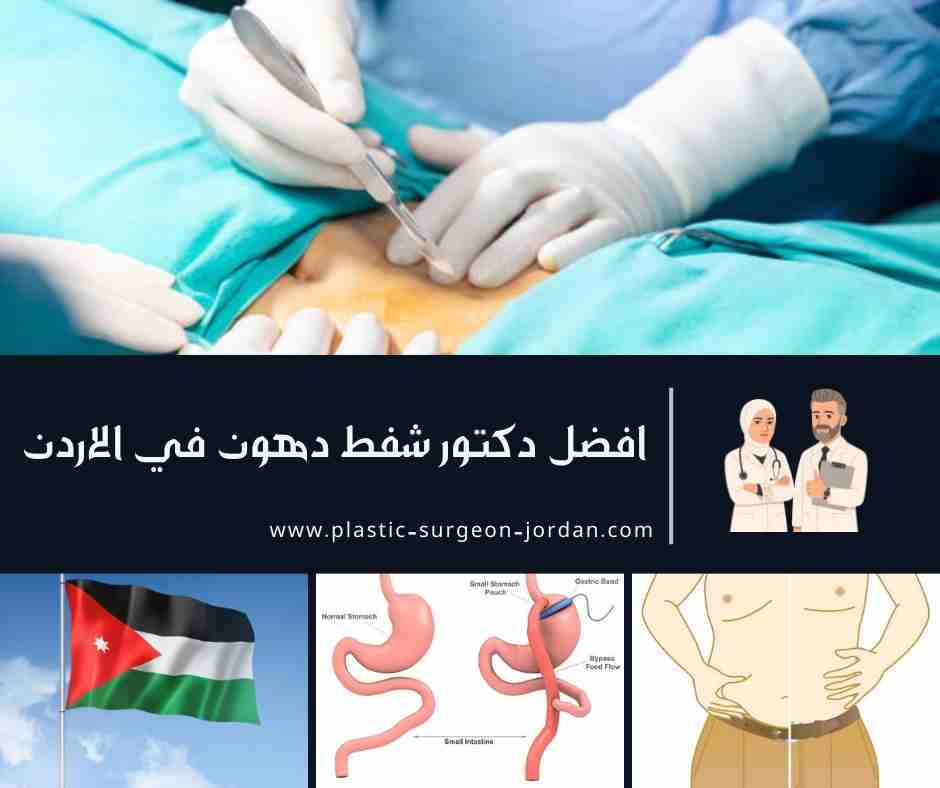 افضل دكتور شفط دهون في الاردن