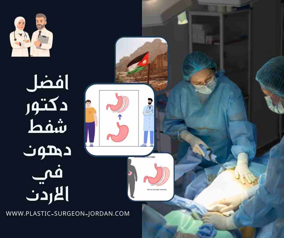 افضل دكتور شفط دهون في الاردن