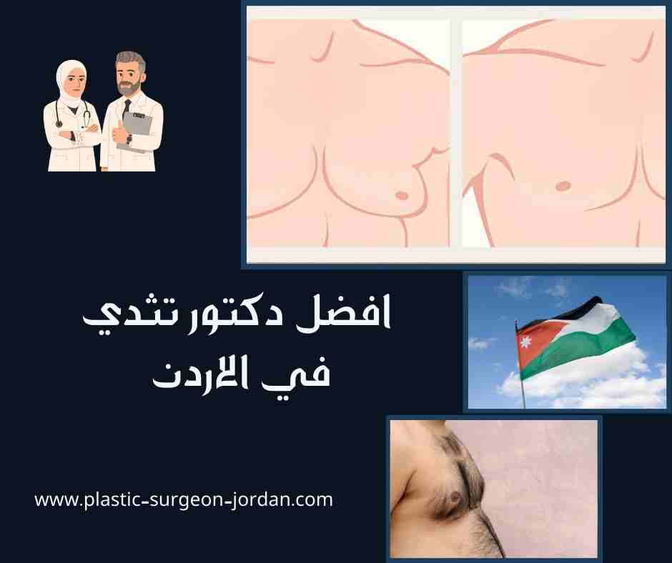افضل دكتور تثدي في الاردن