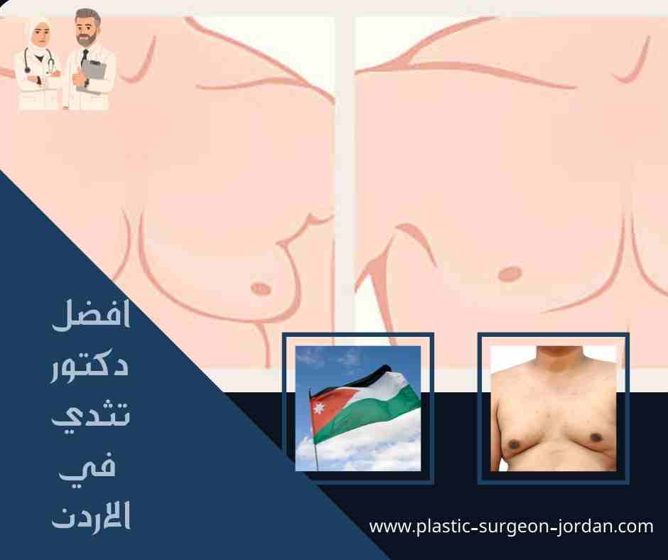 افضل دكتور تثدي في الاردن