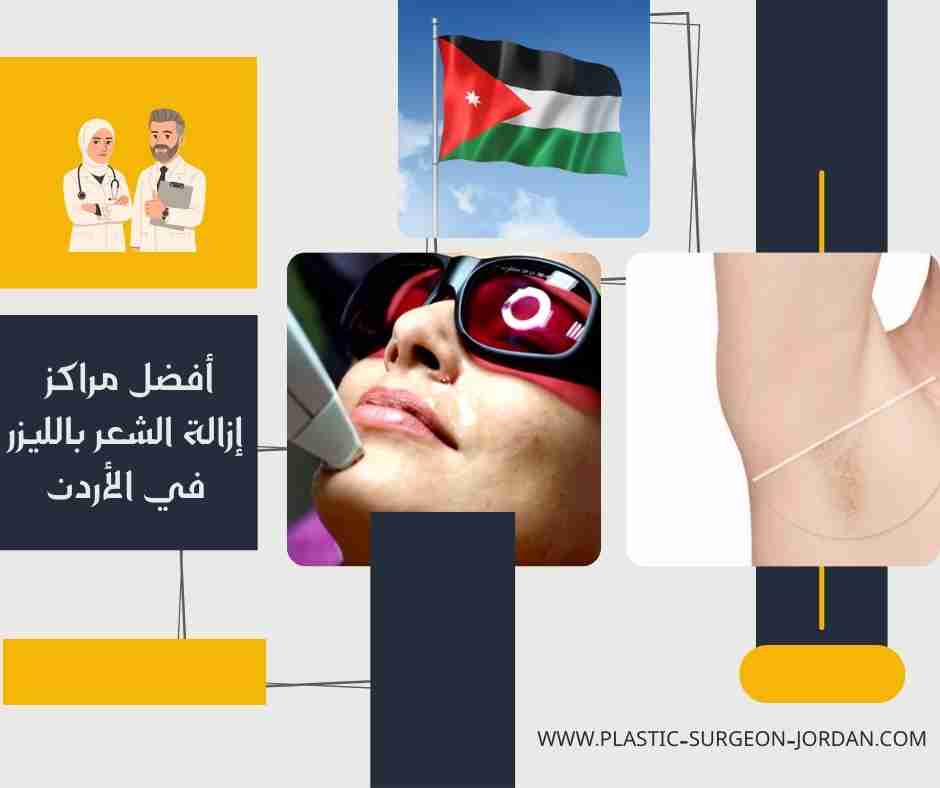 أفضل مراكز إزالة الشعر بالليزر في الأردن
