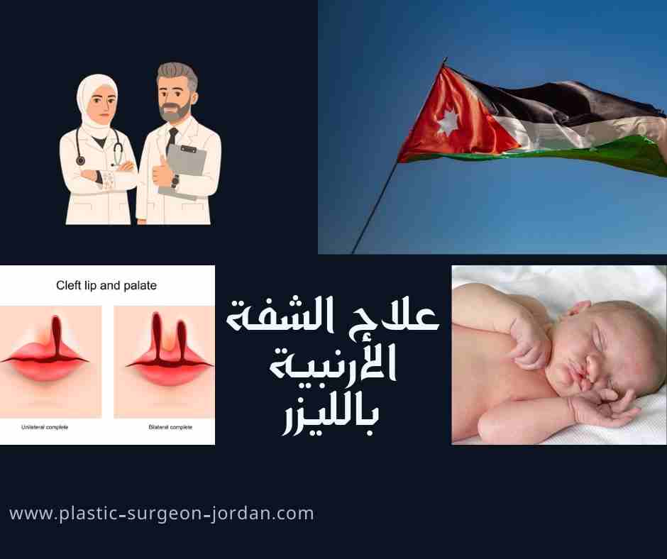 علاج الشفة الأرنبية بالليزر