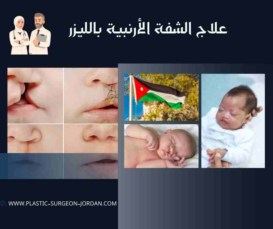 علاج الشفة الأرنبية بالليزر