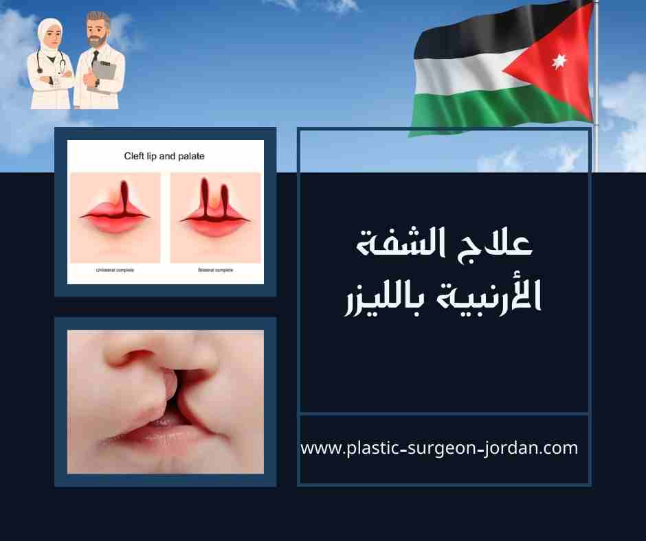 علاج الشفة الأرنبية بالليزر