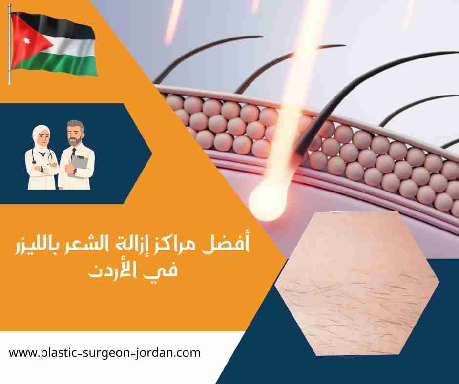 أفضل مراكز إزالة الشعر بالليزر في الأردن