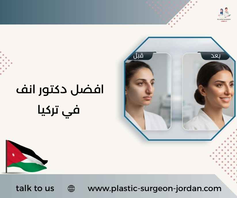 افضل دكتور انف في تركيا
