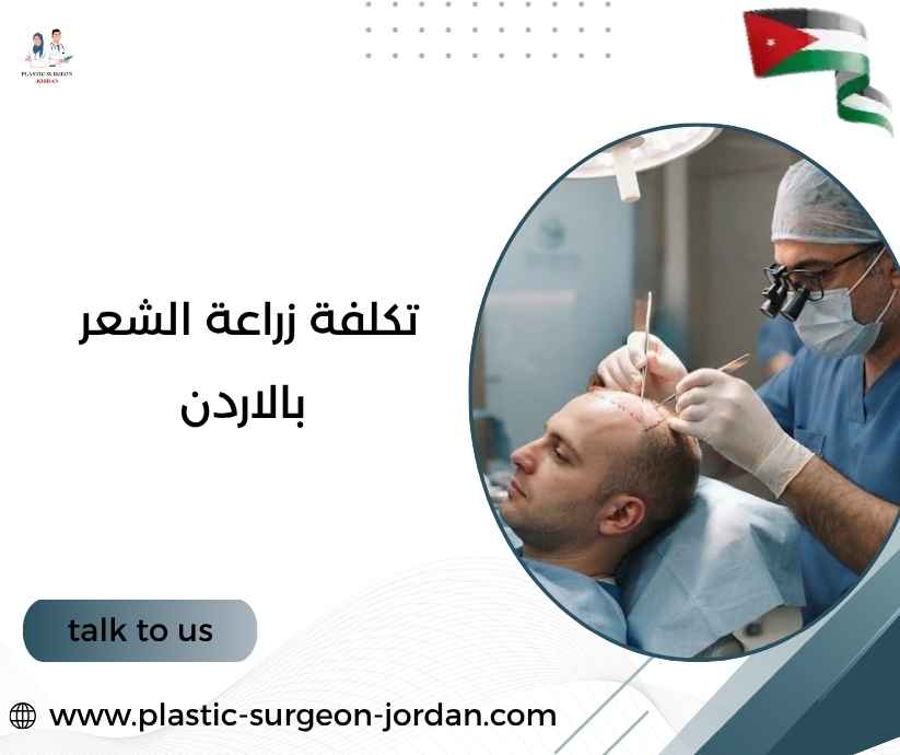 تكلفة زراعة الشعر بالاردن