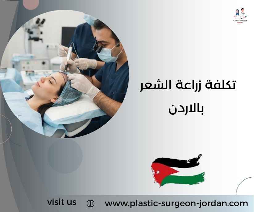 تكلفة زراعة الشعر بالاردن