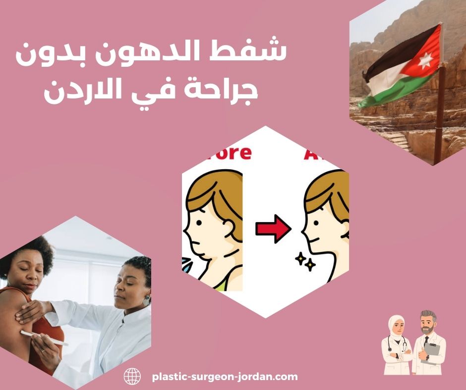 اضرار شفط الدهون بدون جراحة