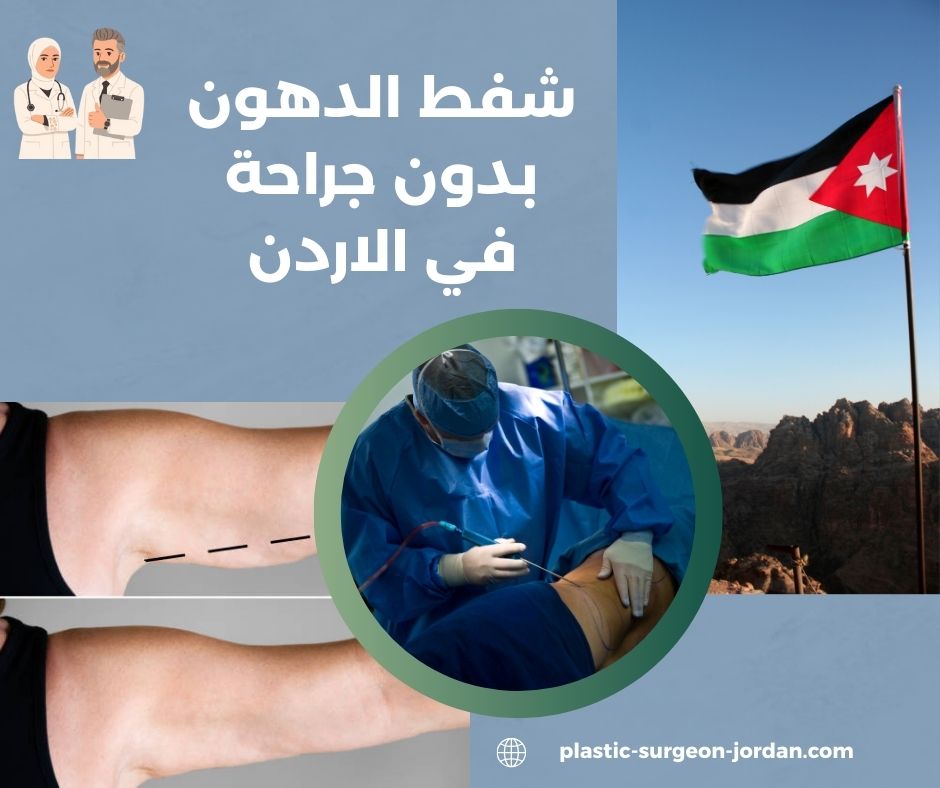شفط الدهون بدون جراحة في الاردن