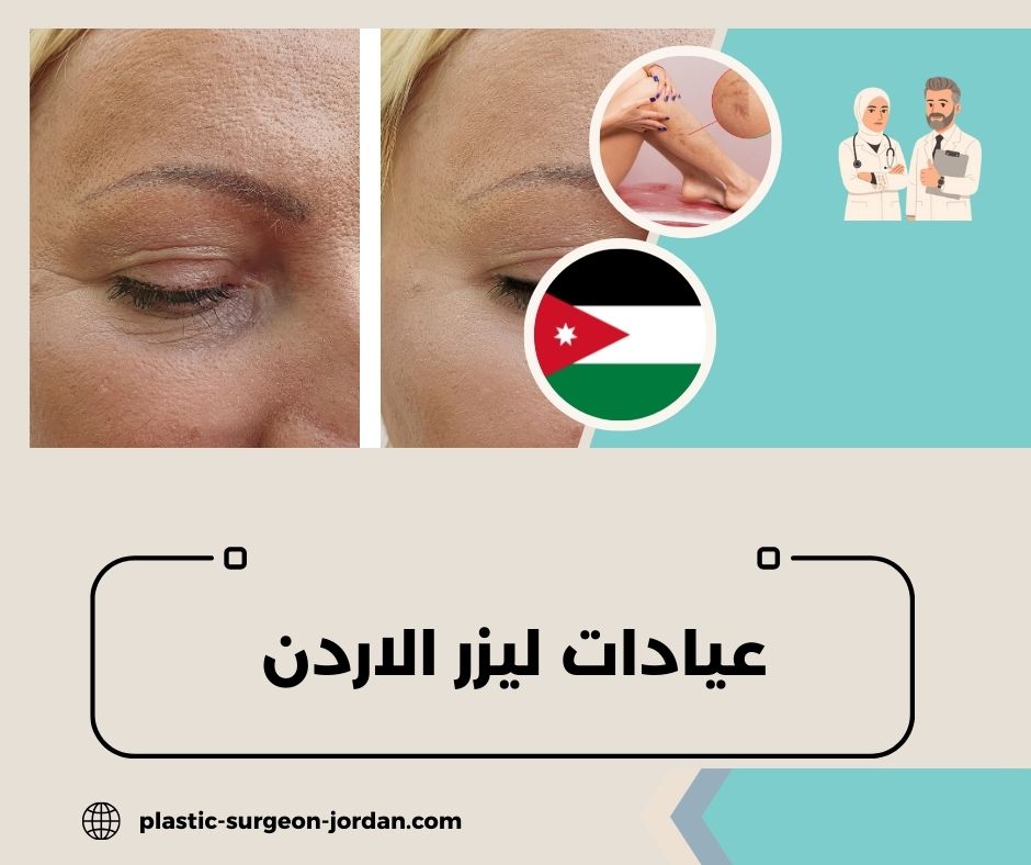 عيادات ليزر في الاردن