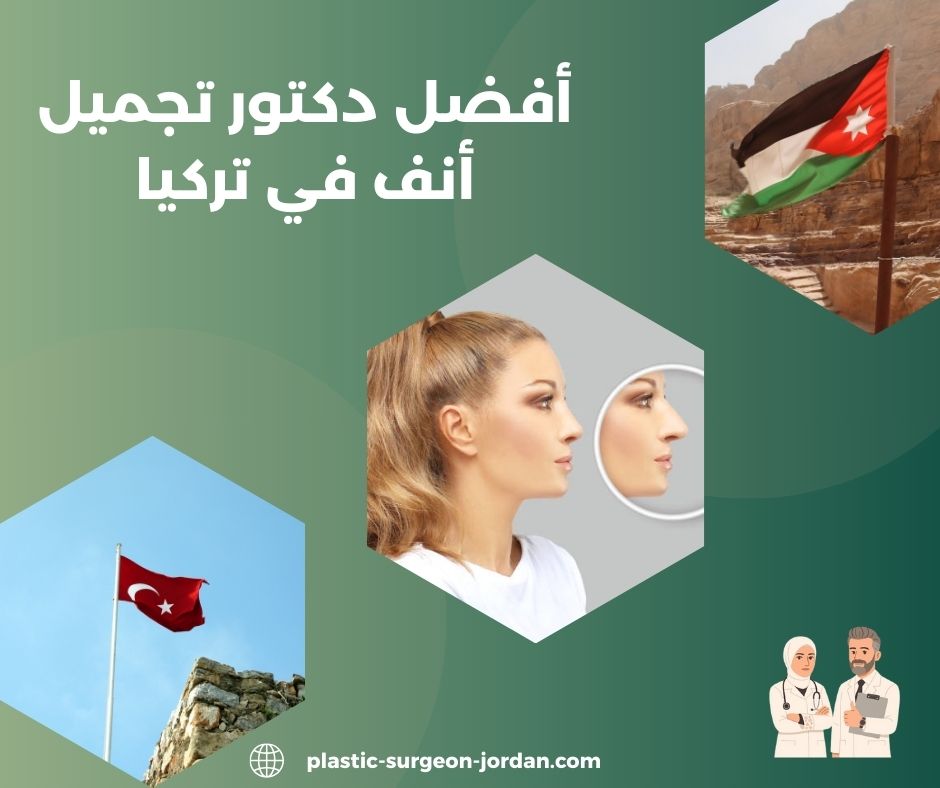 افضل دكتور تجميل انف في تركيا