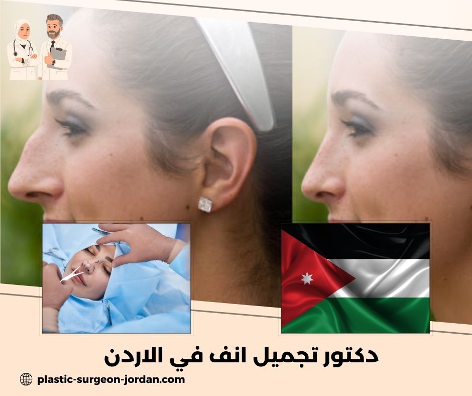 دكتور تجميل انف في الاردن دكتور تجميل انف في الاردن