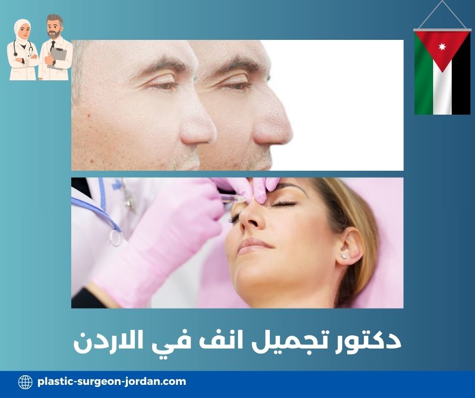 من هو افضل دكتور تجميل انف في الاردن؟ من هو افضل دكتور تجميل انف في الاردن؟